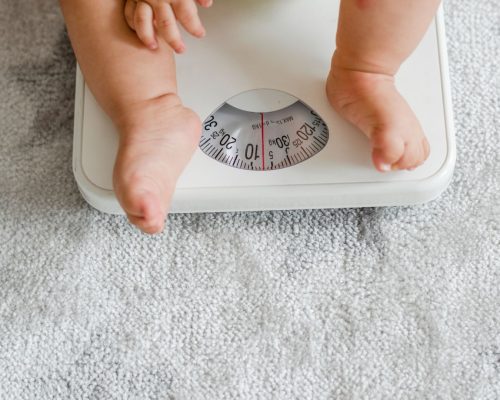 bayi obesitas